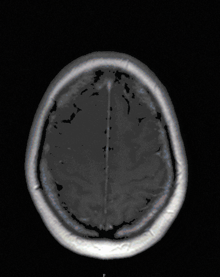 Klein-Brueckenwinkel Klein-Brueckenwinkel